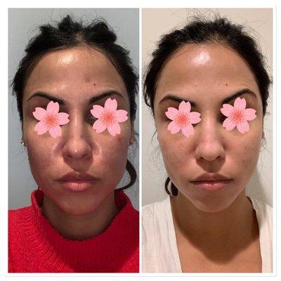 Before & After Treatments - Before & After Treatments
