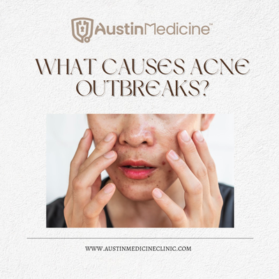 Skincare Solutions - Struggling with acne outbreaks? No worries, we've got you covered! 🌈💪 Austin Medicine offers expert acne support right at your fingertips through our remote skincare consultations. Whether you're at home, on-the-go, or miles away, our dermatology team is ready to provide personalized solutions to address your skin concerns.
Say hello to clear, glowing skin with Austin Medicine's virtual acne solutions! 🌟😍 Skincare Solutions - Struggling with acne outbreaks? No worries, we've got you covered! 🌈💪 Austin Medicine offers expert acne support right at your fingertips through our remote skincare consultations. Whether you're at home, on-the-go, or miles away, our dermatology team is ready to provide personalized solutions to address your skin concerns.
Say hello to clear, glowing skin with Austin Medicine's virtual acne solutions! 🌟😍