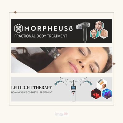 Morpheus8 Treatments - Welcome to Beyondskin Medspa, where innovation meets beauty in the heart of Los Feliz, Los Angeles. Our Morpheus8 treatments redefine the aging process, addressing a range of skin conditions and turning back the clock on your skin and appearance.
** These are examples of patients who have had great results after 3 sessions of Morpheus8. ** Morpheus8 Treatments - Welcome to Beyondskin Medspa, where innovation meets beauty in the heart of Los Feliz, Los Angeles. Our Morpheus8 treatments redefine the aging process, addressing a range of skin conditions and turning back the clock on your skin and appearance.
** These are examples of patients who have had great results after 3 sessions of Morpheus8. **