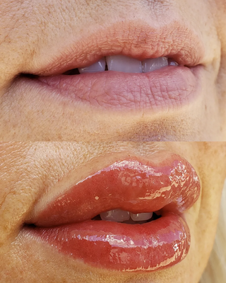 Lip Blush - The color will stay vibrant for a couple days before it softens up and settles so natural and beautiful!! Lip Blush - The color will stay vibrant for a couple days before it softens up and settles so natural and beautiful!!