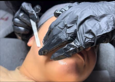 Derma-planing Facial - A gentle procedure in which is exfoliating the skin to remove dead skin cells and hair from the face. With rejuvenating benefits of lightening discoloration, uneven texture, and glowing skin. This treatment includes cleansing, masques, enzymatic exfoliator, and extraction.