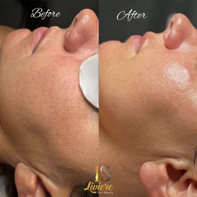 ESSENTIAL FACIAL - Recommended for first-time clients. This service is a complete personalized facial  to treat your unique skin type and needs . Includes double cleanser, skin analysis, detoxifying mask, gentle massage (scalp and arms), hydrating firming mask, ice globes, and final products.
