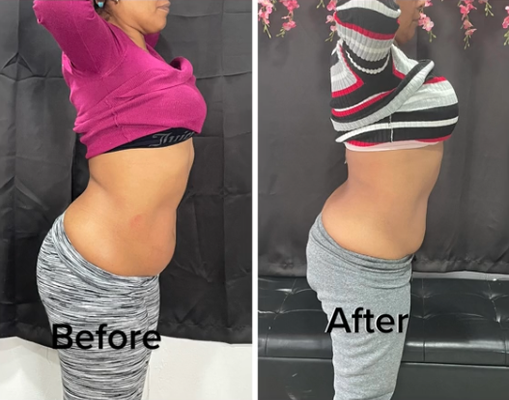 Body Sculpting - Walkins Welcome!
Call today
(508) 3007822
Or
Book your appointment: vagaro.com/luminousaesthetic
