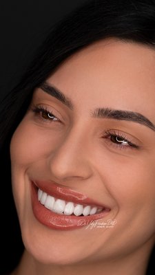 Smile Makeover 10 Teeth | Translucent Porcelain Veneers - 10 Teeth Smile Design | Porcelain Smile Design Veneers: Finance Available with No interest up to 24mo. Get your Hollywood Smile NOW and pay letter. 20 years of experience. Affordable Dental Care. Finance Available. Enjoy this $129/Month special (50% Off Yelp Customers Deal) limited time. Boost your self-confidence with a new beautiful computerized perfect smile. Unbeatable Broward, Miami & Palm Beach Deal. Smile Makeover 10 Teeth | Translucent Porcelain Veneers - 10 Teeth Smile Design | Porcelain Smile Design Veneers: Finance Available with No interest up to 24mo. Get your Hollywood Smile NOW and pay letter. 20 years of experience. Affordable Dental Care. Finance Available. Enjoy this $129/Month special (50% Off Yelp Customers Deal) limited time. Boost your self-confidence with a new beautiful computerized perfect smile. Unbeatable Broward, Miami & Palm Beach Deal.