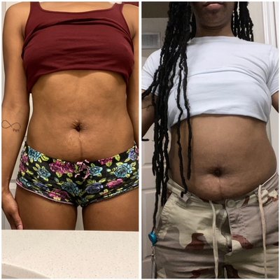 Results! (before and after) - Coach Hope serves women and men 50 and over by helping reverse aging, break generational health through self-care to get you off medication, improve overall health, and get you FIT and FABULOUS at an Age
WHOLE FOOD DIET + EXERCISE + MEDITATION = HEALTHY HEART & MIND
I will educate you on the concept of L. E. A.N. by guiding you through:
How to Live? Lifestyle
How to Move? Exercise
How to Think? Attitude
How to Eat? Nutrition Results! (before and after) - Coach Hope serves women and men 50 and over by helping reverse aging, break generational health through self-care to get you off medication, improve overall health, and get you FIT and FABULOUS at an Age
WHOLE FOOD DIET + EXERCISE + MEDITATION = HEALTHY HEART & MIND
I will educate you on the concept of L. E. A.N. by guiding you through:
How to Live? Lifestyle
How to Move? Exercise
How to Think? Attitude
How to Eat? Nutrition