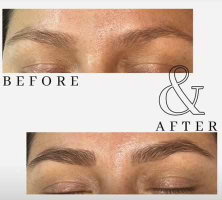 Brows - Choose to prioritize your well-being with a service that elevates both your skin's texture and your
relaxation levels.