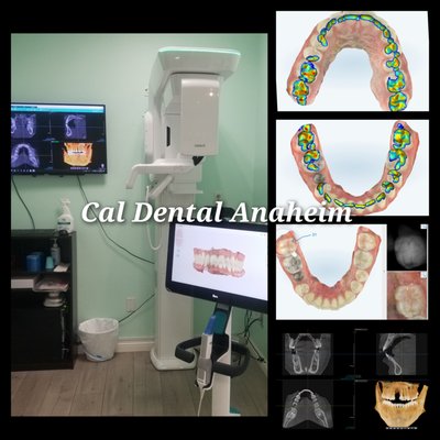 Implant starts from $1,900 - Implant starts from $1,900
Implant and Crown included
High-quality dental service without waiting. If you are looking for a great dentist in Anaheim, please call us. We are open Sunday.
Cal Dental Anaheim
3006 W LINCOLN AVE
ANAHEIM, CA 92801
(714) 828 0508
#implantandcosmeticdentistry
#newesttechnology #Vatechsmartct
#itero5dscanner #CALDENTALANAHEIM Implant starts from $1,900 - Implant starts from $1,900
Implant and Crown included
High-quality dental service without waiting. If you are looking for a great dentist in Anaheim, please call us. We are open Sunday.
Cal Dental Anaheim
3006 W LINCOLN AVE
ANAHEIM, CA 92801
(714) 828 0508
#implantandcosmeticdentistry
#newesttechnology #Vatechsmartct
#itero5dscanner #CALDENTALANAHEIM