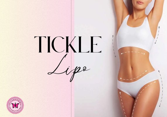 Tickle Lipo - Our Tickle Lipo is a quick in-office procedure with minimal downtime and quick recovery; it's great for body contouring or to get rid of stubborn fat and allows the skin to naturally tighten. Unlike traditional liposuction, Tickle Lipo is performed with a local anesthetic. Patients experience little or no discomfort. In fact, just a tickling sensation is usually reported. In addition to faster recovery times, the results of Tickle Lipo are immediately visible. Pricing for our Tickle Lipo varies per patient, in-person examination is needed to determine the cost. Contact us for a free consultation!