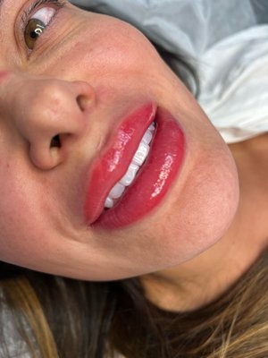 Lip Blush - What does Lip Blushing do?
Semi-Permanent tattoo lip color treatments can improve the appearance of lips for both women and men. It helps the lips to appear more defined and fuller, without surgery or fillers. The color is subtle to give natural-looking results.