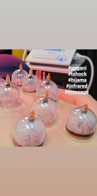 Wet cupping benefits. - Wet cupping can help athletes at all levels. Wet cupping benefits. - Wet cupping can help athletes at all levels.