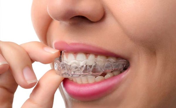 Orthodontics Before & After - Interested in having straighter teeth but not sure if you’re the right candidate or wondering if orthodontic treatment is really worth it? At Sea Summit Dentistry, we’re here to help! We offer a FREE orthodontic consultation where we can evaluate your smile, answer your questions, and help determine the best treatment option for you. Whether you’re interested in clear aligners or traditional braces, we’re excited to help you start your journey toward the smile you’ve always wanted! Take a look at these real results from our patients who chose clear aligners and/or braces! Your straighter, more confident smile may be closer than you think. Call us today at (949) 66-SMILE to schedule your FREE consultation! Orthodontics Before & After - Interested in having straighter teeth but not sure if you’re the right candidate or wondering if orthodontic treatment is really worth it? At Sea Summit Dentistry, we’re here to help! We offer a FREE orthodontic consultation where we can evaluate your smile, answer your questions, and help determine the best treatment option for you. Whether you’re interested in clear aligners or traditional braces, we’re excited to help you start your journey toward the smile you’ve always wanted! Take a look at these real results from our patients who chose clear aligners and/or braces! Your straighter, more confident smile may be closer than you think. Call us today at (949) 66-SMILE to schedule your FREE consultation!