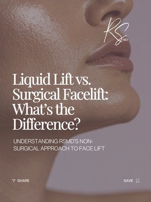 RSMD Liquid Lift - Want to know the difference between a Liquid Lift and surgical facelift?
A Liquid Lift uses strategically placed dermal fillers and BTX to restore volume, support facial structure, and create a subtle lift, without incisions or extended downtime.
Unlike surgery, there’s no lengthy recovery period, no time away from work or daily life, and significantly less financial commitment involved. It’s a more flexible approach for patients looking for noticeable refinement without the disruption of surgery.
Book your consultation at RSMD Medical Aesthetics.
828 Bay Ave, Capitola, CA
831-475-1077 RSMD Liquid Lift - Want to know the difference between a Liquid Lift and surgical facelift?
A Liquid Lift uses strategically placed dermal fillers and BTX to restore volume, support facial structure, and create a subtle lift, without incisions or extended downtime.
Unlike surgery, there’s no lengthy recovery period, no time away from work or daily life, and significantly less financial commitment involved. It’s a more flexible approach for patients looking for noticeable refinement without the disruption of surgery.
Book your consultation at RSMD Medical Aesthetics.
828 Bay Ave, Capitola, CA
831-475-1077