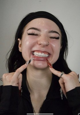 TOOTH GEMS & WHITENING *:･ﾟ✧*:･ﾟ - Add some sparkle to your smile with our tooth gems and teeth whitening services at Dazey Aesthetic Collective. Our tooth gems are a fun and stylish way to express your personality, with a variety of designs that can be applied quickly and safely by our experienced team. If you’re looking to brighten your smile, our professional teeth whitening service offers noticeable results, lifting stains and enhancing the natural brilliance of your teeth. Whether you’re adding a touch of bling or boosting your smile’s radiance, our personalized approach ensures you leave with a look that shines. Book your appointment today and let your smile be your best accessory!