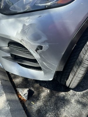 Mercedes-Benz bumper that was cracked and scratched  - Very bad cracked and scratched body shop charged him $1200 had it done for $500 Mercedes-Benz bumper that was cracked and scratched  - Very bad cracked and scratched body shop charged him $1200 had it done for $500