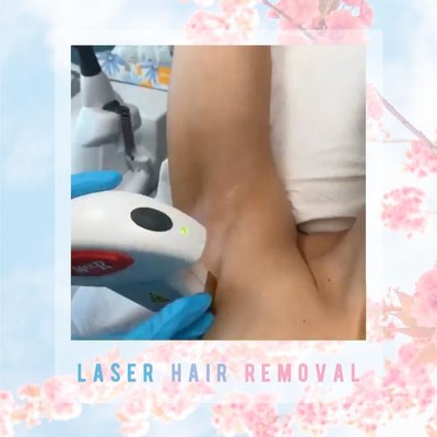 Icon Laser Hair Removal - The ICON MaxR laser hair removal device is a cutting-edge tool designed for effective and long-lasting hair reduction. It utilizes advanced intense pulse light (IPL) technology to target and disable hair follicles, preventing future hair growth. With the MaxR hand piece we can successfully treat areas from face to larger areas such as the legs, back and chest. Its powerful cooling system ensures a comfortable experience by protecting the skin during treatment. It is suitable for various skin types and provides reliable, effective results with fewer sessions compared to traditional laser hair removal methods. Icon Laser Hair Removal - The ICON MaxR laser hair removal device is a cutting-edge tool designed for effective and long-lasting hair reduction. It utilizes advanced intense pulse light (IPL) technology to target and disable hair follicles, preventing future hair growth. With the MaxR hand piece we can successfully treat areas from face to larger areas such as the legs, back and chest. Its powerful cooling system ensures a comfortable experience by protecting the skin during treatment. It is suitable for various skin types and provides reliable, effective results with fewer sessions compared to traditional laser hair removal methods.