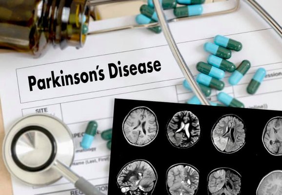 Parkinson's prevention - We actively researching and working hard to prevent parkinson's disease. We treat all of our patients with the utmost care. Whether it's parkinsons or another neurological  issue you still deserve to live a healthy fulfilling life! Give us a call we are here to help.