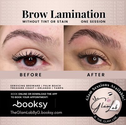 Impermanent Procedures - Before and After Impermanent Procedures - Before and After