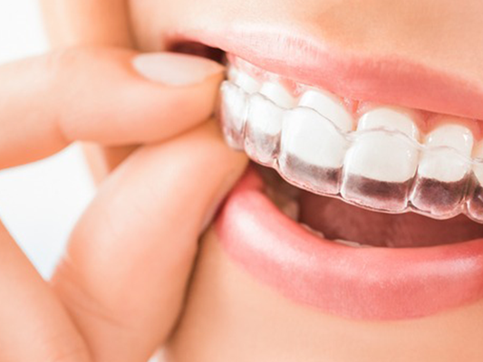 Invisalign - You get customized treatment based on years of research and intelligence from millions of patients.
No guesswork
Straightens your teeth more predictably
Convenient
Clear aligners that are discreet and don’t interrupt your life
The right fit for you
Fits snugly around your teeth Invisalign - You get customized treatment based on years of research and intelligence from millions of patients.
No guesswork
Straightens your teeth more predictably
Convenient
Clear aligners that are discreet and don’t interrupt your life
The right fit for you
Fits snugly around your teeth