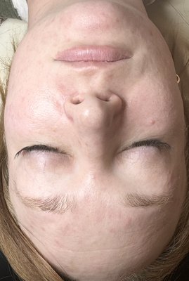 Hydrating facials - These beauties came in just wanting to relax and hydrate their skin. Hydrating facials - These beauties came in just wanting to relax and hydrate their skin.