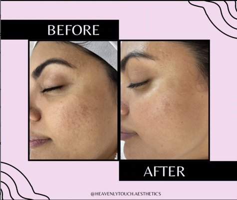 SKIN CARE TREATMENTS - GUA SHA OR ICE GLOBE FACIAL – 45 MIN $80
ESSENTIAL FACIAL – 60 MIN $90
ILLUMINATING FACIAL – 75 MIN $100
PREMIUM FACIAL – 90 MIN $125
BACK FACIAL – $190
DERMAPLANE + CUSTOM MASK $100
DERMAPLANE ADD ON $50
SIGNATURE FLASH FACIAL $75
TEEN FACIAL- $55 SKIN CARE TREATMENTS - GUA SHA OR ICE GLOBE FACIAL – 45 MIN $80
ESSENTIAL FACIAL – 60 MIN $90
ILLUMINATING FACIAL – 75 MIN $100
PREMIUM FACIAL – 90 MIN $125
BACK FACIAL – $190
DERMAPLANE + CUSTOM MASK $100
DERMAPLANE ADD ON $50
SIGNATURE FLASH FACIAL $75
TEEN FACIAL- $55