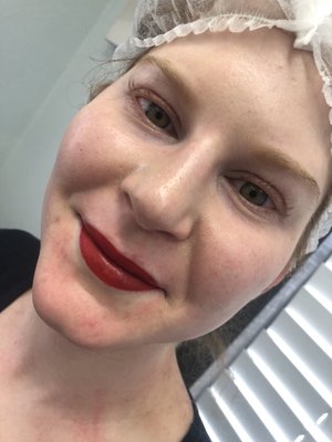 Lip Blush - Lip Liner and Fill Micropigmentation before and after pictures.