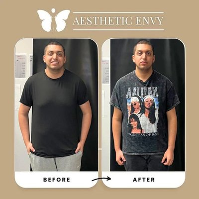 Proven Weight Loss Treatment Solutions - Incredible transformation at Aesthetics Envy!

Alejandro Flores achieved amazing weight loss results and is feeling better than ever! 💪🔥 ‘The team at Aesthetics Envy guided me every step of the way, and I couldn’t be happier with my progress!’

Ready to start your own journey? Let’s do it together!

Book your consultation now @ 916.333.4906