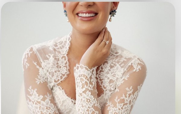 Bridal Bliss: The Journey to a Beautiful Smile - She had always dreamt of her wedding day. As she flipped through bridal magazines and finalized the guest list, one thing was clear: she wanted everything to be perfect. That included her smile.

With only three months left before her wedding, she scheduled an appointment at Miracle Smile Dentistry with Dr. Anna Aller. She had heard about Dr. Aller's expertise in transforming smiles and knew she was in good hands.

When she walked into the clinic, she was greeted warmly by the staff, who immediately put her at ease. Dr. Aller sat with her to discuss her concerns and aspirations for her smile. She explained that she wanted her teeth to look their best for the wedding photos and, most importantly, to feel confident as she walked down the aisle.

Dr. Aller carefully examined her teeth and recommended a personalized treatment plan that included a thorough cleaning, whitening, and a few cosmetic adjustments. She felt reassured by Dr. Aller's confidence and professionalism.

Over the next few weeks, she visited the clinic regularly. Each visit brought her closer to the radiant smile she had always wanted. Dr. Aller and her team worked meticulously, ensuring every detail was perfect. They even provided her with tips on maintaining her smile after the wedding.

As the big day approached, she couldn't help but admire her reflection in the mirror. Her teeth were gleaming, and her smile had never looked better. She felt a surge of confidence and excitement.

On the morning of her wedding, she stood in front of her friends and family, ready to marry the love of her life. When she smiled, her joy was evident to everyone present. Her radiant smile was the perfect complement to her beautiful gown and the love that filled the room.

As she exchanged vows and shared her first kiss as a married woman, she silently thanked Dr. Aller and the team at Miracle Smile Dentistry. Their dedication and expertise had given her more than just a perfect smile—they had given her the confidence to shine on one of the most important days of her life.

Her wedding was everything she had dreamed of, and her smile was a testament to the care and attention she had received. She knew that as she embarked on this new chapter of her life, she would do so with a smile that reflected her happiness and joy.