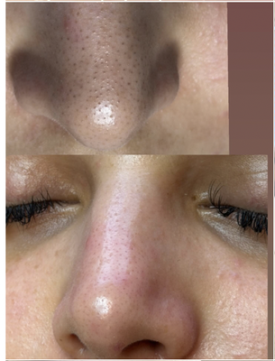 Cleansing pores - With the state of the art equipment, I am determined to give you the results you are looking for. Book your appointment today for a glowing skin! Cleansing pores - With the state of the art equipment, I am determined to give you the results you are looking for. Book your appointment today for a glowing skin!