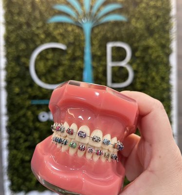 Orthodontic Solutions: Explore Our Range of Options - At our practice, we offer a variety of orthodontic treatments. Each option is designed to fit your unique needs, providing effective and customized solutions for achieving the smile you’ve always wanted. We offer free consultations, so come in and get evaluated by Dr.Pham to determine the best treatment option for you. Let us help you and take the first step toward a confident, beautiful smile!