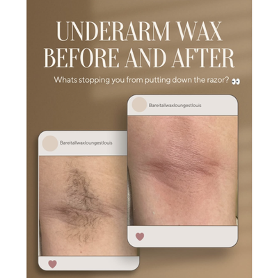 Underarm Waxing - Smooth underarms, zero stubble! Ditch the razor and say hello to long-lasting results with our expert underarm waxing. Confidence starts with silky-smooth skin!

📍Located in Chesterfield MO
🙌🏻 Full-body waxing for men and women
💻Book online at www.bareitallwaxlounge.com
