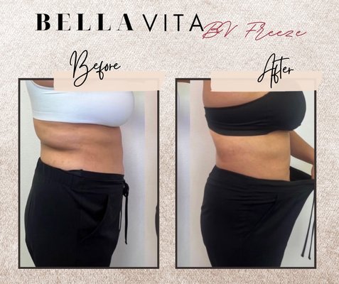 Body Contouring - Bella Vita’s Body Contouring brings out your best self without invasive surgery. Remove fat & cellulite, bring youth back to your face, build muscle, sculpt your body and feel like yourself again, but better!
Book online or call Today!
BV Freeze, BV Lift, Bella Shape, BellaEMS Body Contouring - Bella Vita’s Body Contouring brings out your best self without invasive surgery. Remove fat & cellulite, bring youth back to your face, build muscle, sculpt your body and feel like yourself again, but better!
Book online or call Today!
BV Freeze, BV Lift, Bella Shape, BellaEMS
