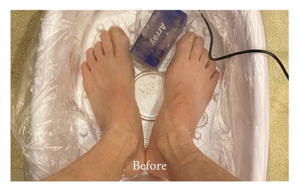 Ionic Detox Therapy sessions available! - Used to cleanse toxins, balance pH, assist in recovery from injuries/surgeries, pain management/inflammation, increase oxygen and cell energy levels, enhance the body’s ability to heal and rebalance on its own. Ionic Detox Therapy sessions available! - Used to cleanse toxins, balance pH, assist in recovery from injuries/surgeries, pain management/inflammation, increase oxygen and cell energy levels, enhance the body’s ability to heal and rebalance on its own.