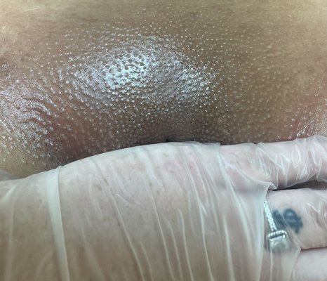 Brazilian Waxes - Complete hair removal from the Brazilian area, in 15 minutes or less, satisfaction guaranteed. Brazilian Waxes - Complete hair removal from the Brazilian area, in 15 minutes or less, satisfaction guaranteed.