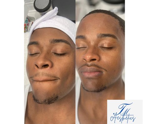 Relaxation or Advanced corrective facials - Advanced and relaxation facials. Relaxation or Advanced corrective facials - Advanced and relaxation facials.