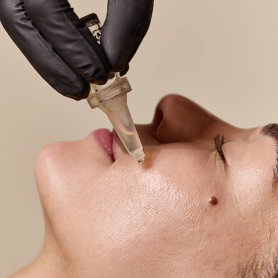 Rejuvenate & Glow: Gentle Chemical Peels That Transform Your Skin - Brighten, tighten and rejuvenate with our gentle chemical peels—powerful results without harsh peeling. Choose Rejuvenator for hyperpigmentation and fine lines, or Revitalizer for deep cleansing and acne-prone skin. Safe for all skin types with minimal downtime.