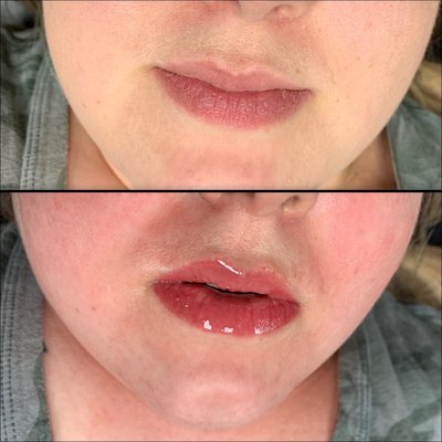 Skin care - Beautiful results after every treatment Skin care - Beautiful results after every treatment