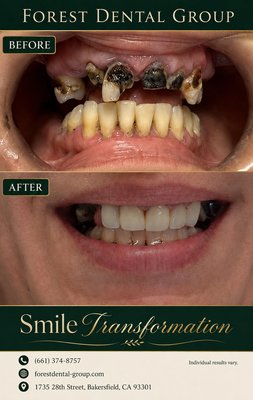 Smile transformation - Your smile matters , give us the chance to make smile transformation