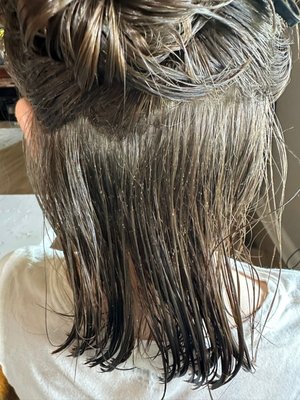 severe lice infestation - severe infestation more than 8 weeks severe lice infestation - severe infestation more than 8 weeks