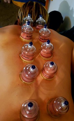 Deep tissue, Thai therapeutic - 90 minutes (deep tissue, cupping or hot stones) Deep tissue, Thai therapeutic - 90 minutes (deep tissue, cupping or hot stones)