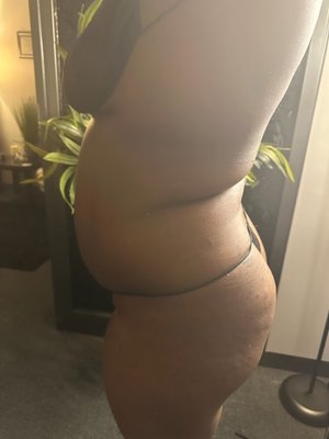 Post Op massage - Cavitation & vacuum therapy for waist reduction Post Op massage - Cavitation & vacuum therapy for waist reduction