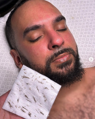 Dermaplaning facial - Exfoliates while getting rid of dead skin, debris and peach fuzz, making your skin smooth and even toned.