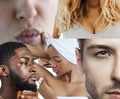 Will Electrolysis Work for Me? - Will Electrolysis Work for Me?
Have you been told that, for one reason or another, hair removal won’t work on you? Well, I’ve got good news for you. It may be true that other methods of hair removal won’t work on you, but electrolysis will. That’s because electrolysis works on all skin and hair types, colors and shades. It even works on people experiencing certain conditions.
Electrolysis is a safe and effective solution for anyone wishing to remove unwanted hair permanently. This includes women and men, teens and adults, and people with all different needs, circumstances and goals. Here are just some of the types of people often told hair removal won’t work on them who can–and do–receive great value from treatment with electrolysis.
Coarse, Curly or Wavy Haired People
If you’ve ever been told that you’re not a candidate for treatment to remove unwanted hair because of your hair type, you need to speak with a professional electrologist, because it is effective for all kinds of hair, including hair that is coarse, curly or wavy.
This applies whatever the reason for your hair type, be that the tendency for people with your darker skin tone or if your straight hair has become ingrown.Those with curly hair are more likely to have ingrown hair or notice raised bumps on the skin, while coarse hair can get stuck beneath the skin. While tweezing, shaving or depilatories can produce some temporary relief, those methods can be very hard on the skin, potentially worsening the problem and causing skin discoloration or even scarring.
Electrolysis, on the other hand, can safely, effectively and permanently remove damaging ingrown, coarse and curly hairs without the risk of those problems or other negative side effects.
People With Unwanted Hair on the Breasts and Other Sensitive Areas
Many women get electrolysis to remove unwanted hair from their breasts and other sensitive areas safely and permanently. While the breasts can be sensitive to the touch, they are generally not particularly sensitive to sensations from electrolysis treatment. If you’ve been tweezing these hairs, they can grow coarse and hide how much hair you actually have in that area. Those hairs must grow back before they can be permanently eliminated.
People With Ingrown Hairs
Repeated shaving, tweezing and tightly-worn clothing can lead to ingrown hairs trapped below the skin. Electrolysis can eliminate this hair in time, ultimately relieving any irritation you may feel in these areas.
Dark-Skinned People
While dark skin poses a challenge for other methods of hair removal, they do not do so for electrolysis, which is effective on all colors and shades of skin.
Those With PCOS or Hormonal Imbalances
As people’s hormones fluctuate throughout their lives or as a result of HRT (hormone-replacement therapy), they can find hair growing in new and unexpected places. Whatever the cause, electrolysis can be the solution to ridding those areas of the unwanted hair.
These are just some of the more common types of people and circumstances that benefit from electrolysis. To find out how electrolysis can help you, contact Cori at BGE Electrolysis today.
Gray-Haired and White-Haired Folks
While traditional electrolysis methods may have difficulty locating the follicles of gray hair and white hair in order to remove them, there is another method that allows the electrologist to see those follicles. Cori is trained and experienced in using this method and removing gray hairs and white hairs from her clients. Will Electrolysis Work for Me? - Will Electrolysis Work for Me?
Have you been told that, for one reason or another, hair removal won’t work on you? Well, I’ve got good news for you. It may be true that other methods of hair removal won’t work on you, but electrolysis will. That’s because electrolysis works on all skin and hair types, colors and shades. It even works on people experiencing certain conditions.
Electrolysis is a safe and effective solution for anyone wishing to remove unwanted hair permanently. This includes women and men, teens and adults, and people with all different needs, circumstances and goals. Here are just some of the types of people often told hair removal won’t work on them who can–and do–receive great value from treatment with electrolysis.
Coarse, Curly or Wavy Haired People
If you’ve ever been told that you’re not a candidate for treatment to remove unwanted hair because of your hair type, you need to speak with a professional electrologist, because it is effective for all kinds of hair, including hair that is coarse, curly or wavy.
This applies whatever the reason for your hair type, be that the tendency for people with your darker skin tone or if your straight hair has become ingrown.Those with curly hair are more likely to have ingrown hair or notice raised bumps on the skin, while coarse hair can get stuck beneath the skin. While tweezing, shaving or depilatories can produce some temporary relief, those methods can be very hard on the skin, potentially worsening the problem and causing skin discoloration or even scarring.
Electrolysis, on the other hand, can safely, effectively and permanently remove damaging ingrown, coarse and curly hairs without the risk of those problems or other negative side effects.
People With Unwanted Hair on the Breasts and Other Sensitive Areas
Many women get electrolysis to remove unwanted hair from their breasts and other sensitive areas safely and permanently. While the breasts can be sensitive to the touch, they are generally not particularly sensitive to sensations from electrolysis treatment. If you’ve been tweezing these hairs, they can grow coarse and hide how much hair you actually have in that area. Those hairs must grow back before they can be permanently eliminated.
People With Ingrown Hairs
Repeated shaving, tweezing and tightly-worn clothing can lead to ingrown hairs trapped below the skin. Electrolysis can eliminate this hair in time, ultimately relieving any irritation you may feel in these areas.
Dark-Skinned People
While dark skin poses a challenge for other methods of hair removal, they do not do so for electrolysis, which is effective on all colors and shades of skin.
Those With PCOS or Hormonal Imbalances
As people’s hormones fluctuate throughout their lives or as a result of HRT (hormone-replacement therapy), they can find hair growing in new and unexpected places. Whatever the cause, electrolysis can be the solution to ridding those areas of the unwanted hair.
These are just some of the more common types of people and circumstances that benefit from electrolysis. To find out how electrolysis can help you, contact Cori at BGE Electrolysis today.
Gray-Haired and White-Haired Folks
While traditional electrolysis methods may have difficulty locating the follicles of gray hair and white hair in order to remove them, there is another method that allows the electrologist to see those follicles. Cori is trained and experienced in using this method and removing gray hairs and white hairs from her clients.