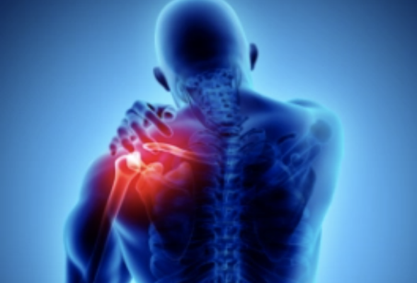 Immunity & Inflammation - A healthy immune system is a core pillar of optimal health. Proper inflammatory responses provide broad spectrum protection against infections and orchestrate long-term adaptive immunity toward specific germs as well as maintaining robust repair of all tissues. In contrast, chronic and uncontrolled inflammation often inflicts severe tissue damage resulting in major pathogenicity from overzealous immune responses. An improper immune response is at the heart of every disease process! Even a heart attack is basically an improper immune response and repair process!
The immune system has many roles: Defense , Repair, Energy Balance, Growth and Differentiation and Homeostasis...
A balanced immune system goes unnoticed in your life, in other words you handle minor illnesses easily, your wounds repair seemingly miraculously, you have energy to work and play, you have joy and peace and deep restorative sleep. However, you have none or very little of those benefits if you have an imbalanced, dysregulated or deficient immune system. Instead, your life is wracked with recurrent infections, allergy, autoimmunity, chronic pain, diabetes, debilitating fatigue, cardiovascular disease, dementia or cancer. All of these conditions are related to an improper immune response to your body’ s ecosystem. In other words, your individual genetic makeup, environment, nutrition status, physical activity, and sleep hygiene all factor in to determine your immune response. If you are born with an immune deficiency, you may be missing certain key cell lines or immune fighting proteins (or defending soldiers to keep it simple). Depending on what the deficiency is determines what your symptoms are. Frequent upper respiratory infections, ear infections, tonsillitis, gastroenteritis, food allergy may be secondary to IgA deficiency for example. Other types of immune deficiency can lead to profound debilitating fatigue - one type may not even appear until your 4th decade! However, for the majority of the population, unhealthy lifestyle is the trigger for unhealthy immune responses! Yes, your food choices, exercise habits and sleep can be the trigger of your thyroid dysfunction or your hormone imbalance! The immune system rules how you heal and repair. Poor healing leads to chronic inappropriate inflammatory response and that is what we label as a specific disease. For example, arthritis is chronic inflammation in a joint space. Rather than addressing the healing response, conventional medicine practice simply blocks the pain symptom, but does not address the root cause.
There are many actionable items Dr. Cocke can utilize to modify your inflammatory responses thereby making (incredible, phenomenal ) improvements in your health, wellbeing, energy, pain, illness, and vitality. You can do it! Arm and balance your Immune system!! Let it work for you - not against you! Immunity & Inflammation - A healthy immune system is a core pillar of optimal health. Proper inflammatory responses provide broad spectrum protection against infections and orchestrate long-term adaptive immunity toward specific germs as well as maintaining robust repair of all tissues. In contrast, chronic and uncontrolled inflammation often inflicts severe tissue damage resulting in major pathogenicity from overzealous immune responses. An improper immune response is at the heart of every disease process! Even a heart attack is basically an improper immune response and repair process!
The immune system has many roles: Defense , Repair, Energy Balance, Growth and Differentiation and Homeostasis...
A balanced immune system goes unnoticed in your life, in other words you handle minor illnesses easily, your wounds repair seemingly miraculously, you have energy to work and play, you have joy and peace and deep restorative sleep. However, you have none or very little of those benefits if you have an imbalanced, dysregulated or deficient immune system. Instead, your life is wracked with recurrent infections, allergy, autoimmunity, chronic pain, diabetes, debilitating fatigue, cardiovascular disease, dementia or cancer. All of these conditions are related to an improper immune response to your body’ s ecosystem. In other words, your individual genetic makeup, environment, nutrition status, physical activity, and sleep hygiene all factor in to determine your immune response. If you are born with an immune deficiency, you may be missing certain key cell lines or immune fighting proteins (or defending soldiers to keep it simple). Depending on what the deficiency is determines what your symptoms are. Frequent upper respiratory infections, ear infections, tonsillitis, gastroenteritis, food allergy may be secondary to IgA deficiency for example. Other types of immune deficiency can lead to profound debilitating fatigue - one type may not even appear until your 4th decade! However, for the majority of the population, unhealthy lifestyle is the trigger for unhealthy immune responses! Yes, your food choices, exercise habits and sleep can be the trigger of your thyroid dysfunction or your hormone imbalance! The immune system rules how you heal and repair. Poor healing leads to chronic inappropriate inflammatory response and that is what we label as a specific disease. For example, arthritis is chronic inflammation in a joint space. Rather than addressing the healing response, conventional medicine practice simply blocks the pain symptom, but does not address the root cause.
There are many actionable items Dr. Cocke can utilize to modify your inflammatory responses thereby making (incredible, phenomenal ) improvements in your health, wellbeing, energy, pain, illness, and vitality. You can do it! Arm and balance your Immune system!! Let it work for you - not against you!