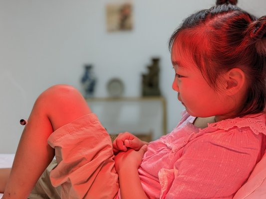 Treating an 8 yr old girl - Treating an 8 year old girl for her headache with acupuncture and moxa.
The results were great, and the girl was so exicted about the whole treatment procedure. Treating an 8 yr old girl - Treating an 8 year old girl for her headache with acupuncture and moxa.
The results were great, and the girl was so exicted about the whole treatment procedure.