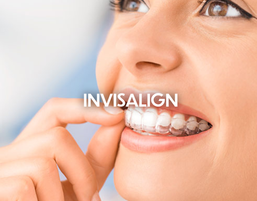 Invisalign - Invisalign is a series of clear aligners that actively move the teeth to more ideal positions over time. Patients love this treatment because they can re-align their teeth without having to wear traditional metal braces. The average treatment time is less than 1 year.