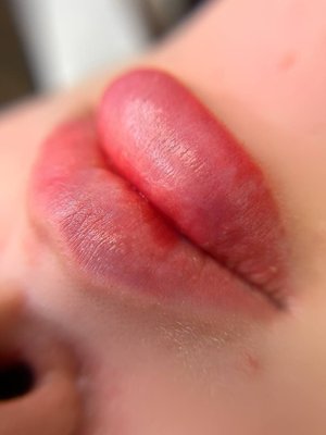 Lip Blushing - “Our client desired more color definition for her lips. Using the lip blushing technique, we enhanced the natural tone and shape, leaving a soft, rosy look that reduces the need for daily lipstick.” Lip Blushing - “Our client desired more color definition for her lips. Using the lip blushing technique, we enhanced the natural tone and shape, leaving a soft, rosy look that reduces the need for daily lipstick.”