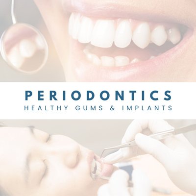 Periodontics - Searching for a Periodontist in Chino? Periodontal disease, which is also called periodontitis and gum disease, is the main cause of tooth loss among adults. This condition is only curable in its earliest stage, and that is why your periodontist in Upland and Chino provides such thorough preventive care. Keeping your gums healthy requires that you floss and brush regularly and never miss a teeth cleaning appointment. Periodontics - Searching for a Periodontist in Chino? Periodontal disease, which is also called periodontitis and gum disease, is the main cause of tooth loss among adults. This condition is only curable in its earliest stage, and that is why your periodontist in Upland and Chino provides such thorough preventive care. Keeping your gums healthy requires that you floss and brush regularly and never miss a teeth cleaning appointment.