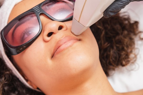 Laser Hair Removal - Tired of unwanted facial hairs? Our laser is here to save the day!
The excel V+ laser is here to remove any unwanted hairs on the face or the body in as few as six treatments.
Wondering if excel v+ is safe for your skin tone?
The answer is YES. Our excel V+ works amazing from the lightest skin tone to the darkest skin tone.
Our excel V+ has a 1064 wavelength and contact cooling that protects the skin during the treatments, reducing the chance of complications.
Call or text us to book today at 610-634-8500
or schedule online at www.liudermatology.com Laser Hair Removal - Tired of unwanted facial hairs? Our laser is here to save the day!
The excel V+ laser is here to remove any unwanted hairs on the face or the body in as few as six treatments.
Wondering if excel v+ is safe for your skin tone?
The answer is YES. Our excel V+ works amazing from the lightest skin tone to the darkest skin tone.
Our excel V+ has a 1064 wavelength and contact cooling that protects the skin during the treatments, reducing the chance of complications.
Call or text us to book today at 610-634-8500
or schedule online at www.liudermatology.com