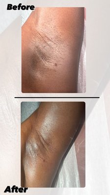 Underarms - Organic sugaring paste Underarms - Organic sugaring paste
