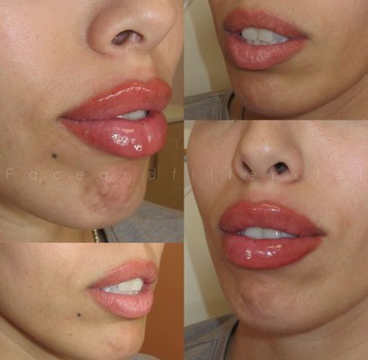 Elevate your confidence & embrace your natural beauty - Face&Filler is an AZ-based medical spa that offers customized services to enhance your natural beauty and boost your self-confidence. We are dedicated to providing personalized care and attention, ensuring you leave each visit feeling revitalized, rejuvenated, and confident! Elevate your confidence & embrace your natural beauty - Face&Filler is an AZ-based medical spa that offers customized services to enhance your natural beauty and boost your self-confidence. We are dedicated to providing personalized care and attention, ensuring you leave each visit feeling revitalized, rejuvenated, and confident!